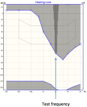 FRESH noise on the OTOsuite Hearing Loss Simulator