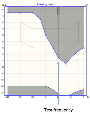 pure tone on the OTOsuite Hearing Loss Simulator