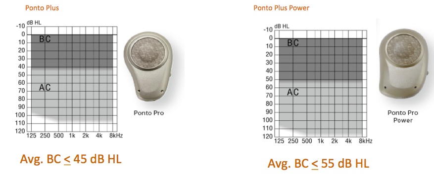 Fitting ranges for Ponto Plus and Ponto Plus Power