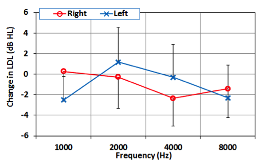 decibel meaning