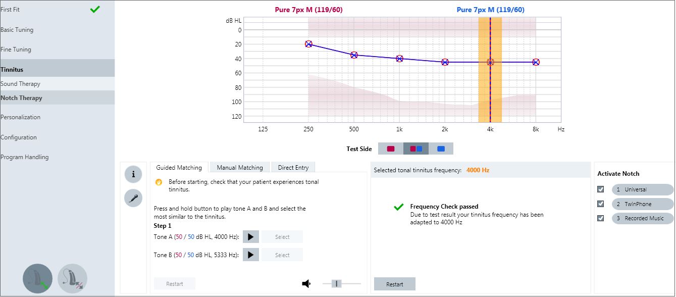 Tonal Tinnitus Therapy screen in Connexx 8.2