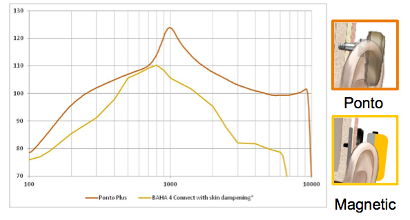 Direct drive versus skin drive approach