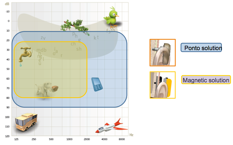 Audiogram with speech banana showing audible range for Ponto solution versus a magnetic solution