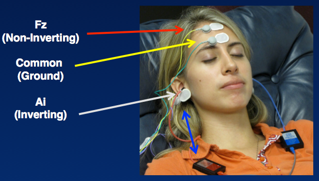ABR Electrode locations