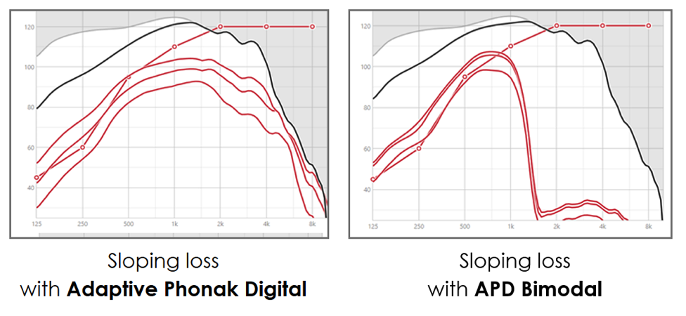 Comparison of the Adaptive Phonak Digital and the APD Bimodal fitting formulas with a sloping hearing loss