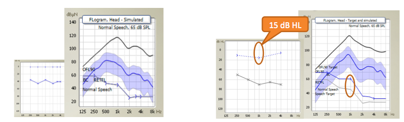 Two audiograms and their corresponding FLograms