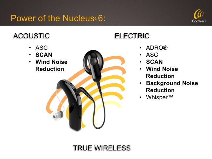 Signal processing algorithms available in the Nucleus 6 Sound Processor