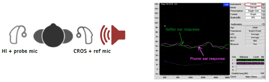 Measuring the aided response on the poorer hearing ear using an audiometric graph