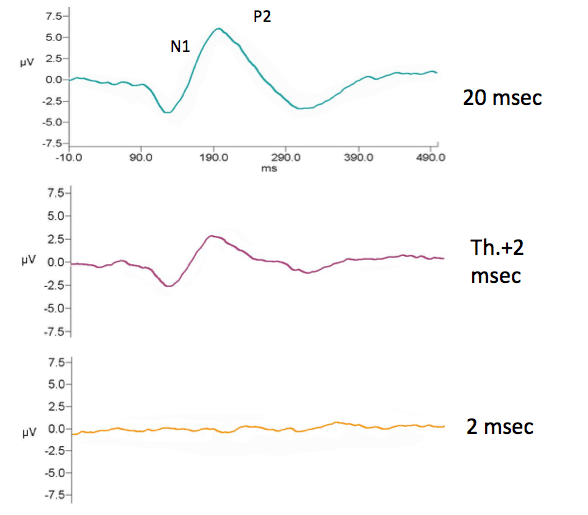N1-P2 responses to gaps in broadband noise in young adults with normal hearing