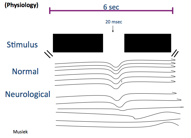 Illustration of neurons responding to gap