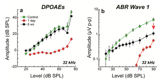 Despite threshold recovery, synaptopathic ears show permanent declines in ABR 