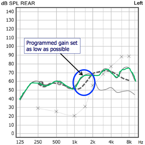 REAR with programmed gain set as low as possible in low frequencies