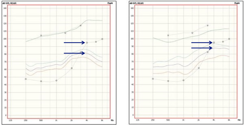 Fitting targets compared to patient thresholds for NAL-NL2 versus DSLv5