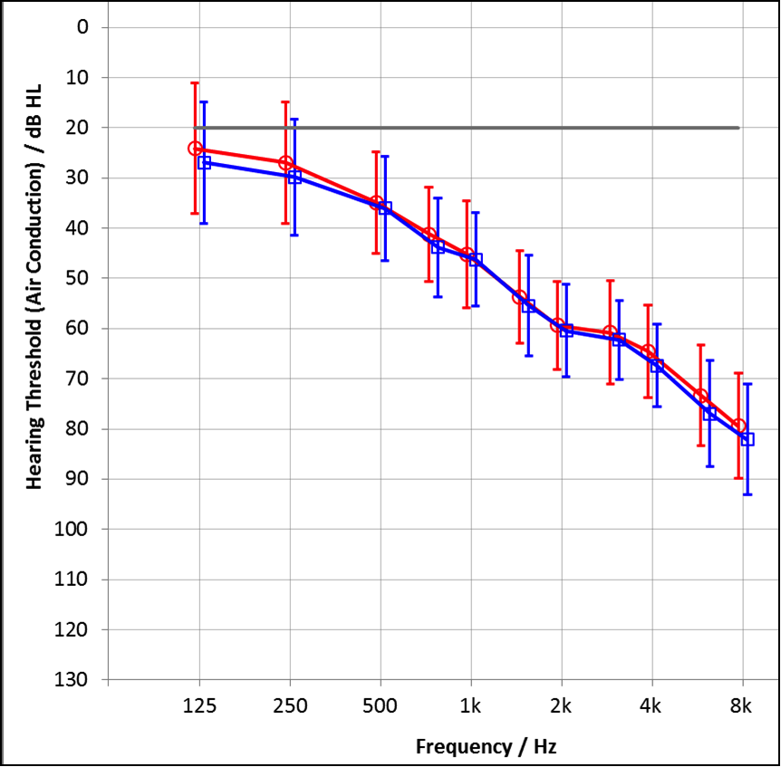 Mean audiogram of the right and left ears of the participants