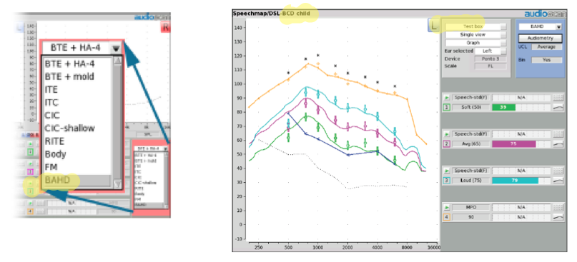 Selecting BAHD as the device type, prompts the software to move into bone conduction fitting mode