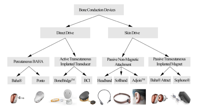 Bone conduction hearing devices