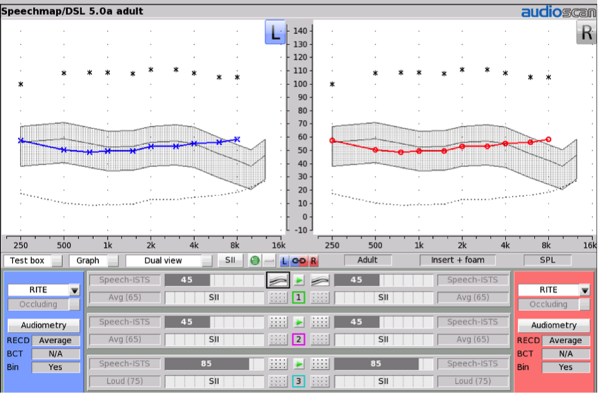 Speech Intelligibility Index Chart