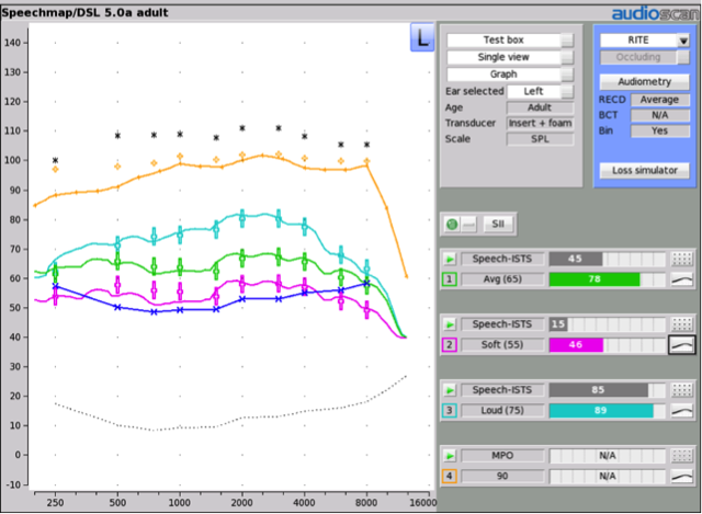 Hearing aid responses for speech at 55, 65, and 75 dB SPL