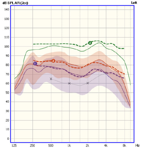 Speech Intelligibility Index Chart