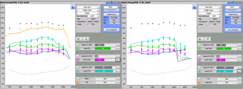 Speech Intelligibility Index Chart