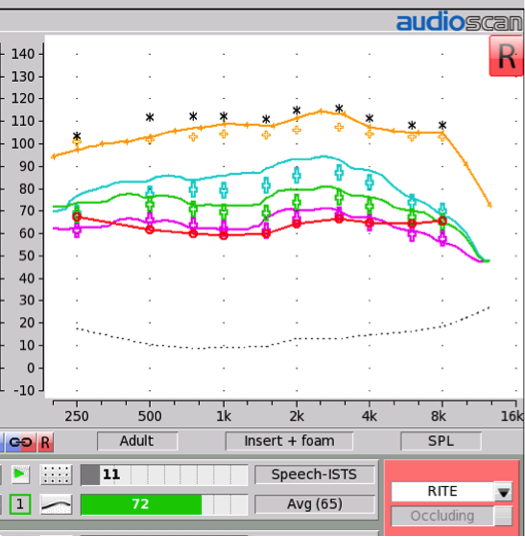 Speech Intelligibility Index Chart