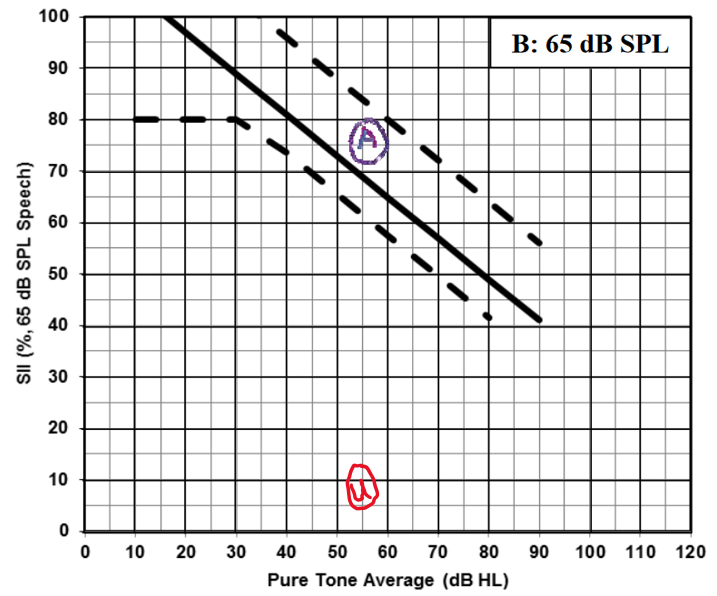 Typical ranges for aided SII, for speech at 65 dB SPL