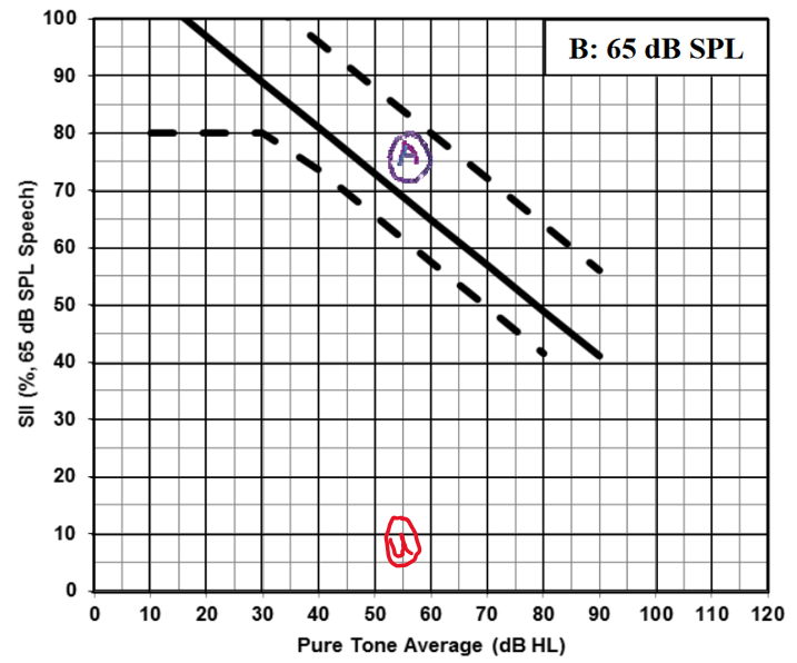 Speech Intelligibility Index Chart