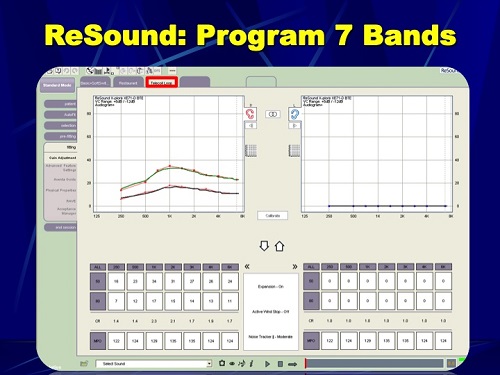 ReSound software screen shot to program overall gain in the telecoil