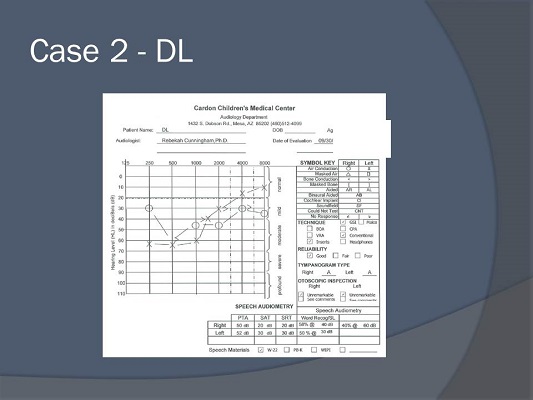 Audiometric data for case study DL