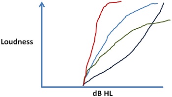 Typical patterns of loudness growth that can be seen in different patients or between different ears