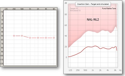 Moderate flat hearing loss and NAL-NL2 prescription for this hearing loss with roll-off in the low-frequencies