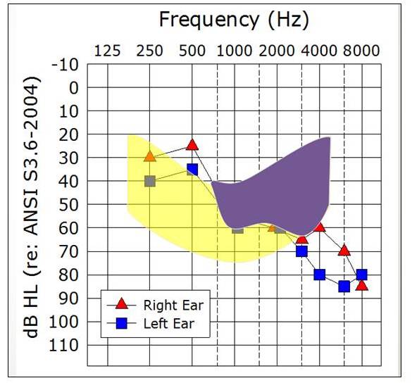 Sample audiogram with LTASS that roughly corresponds to a 75 dB HL presentation level