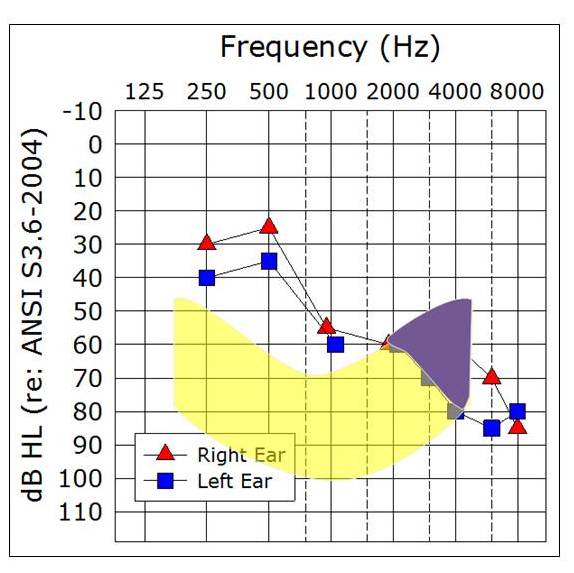 Sample audiogram with LTASS that roughly corresponds to a 100-105 dB HL presentation level