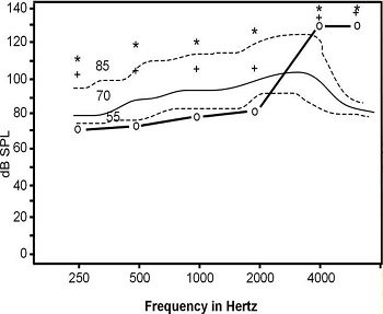 General auditory mapping for soft, average and loud inputs for right ear hearing thresholds using the average RECD