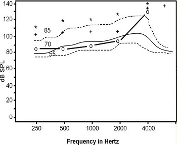 Auditory mapping using individual RECD data