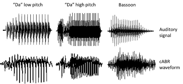 The cABR waveform looks like the signal used to evoke it