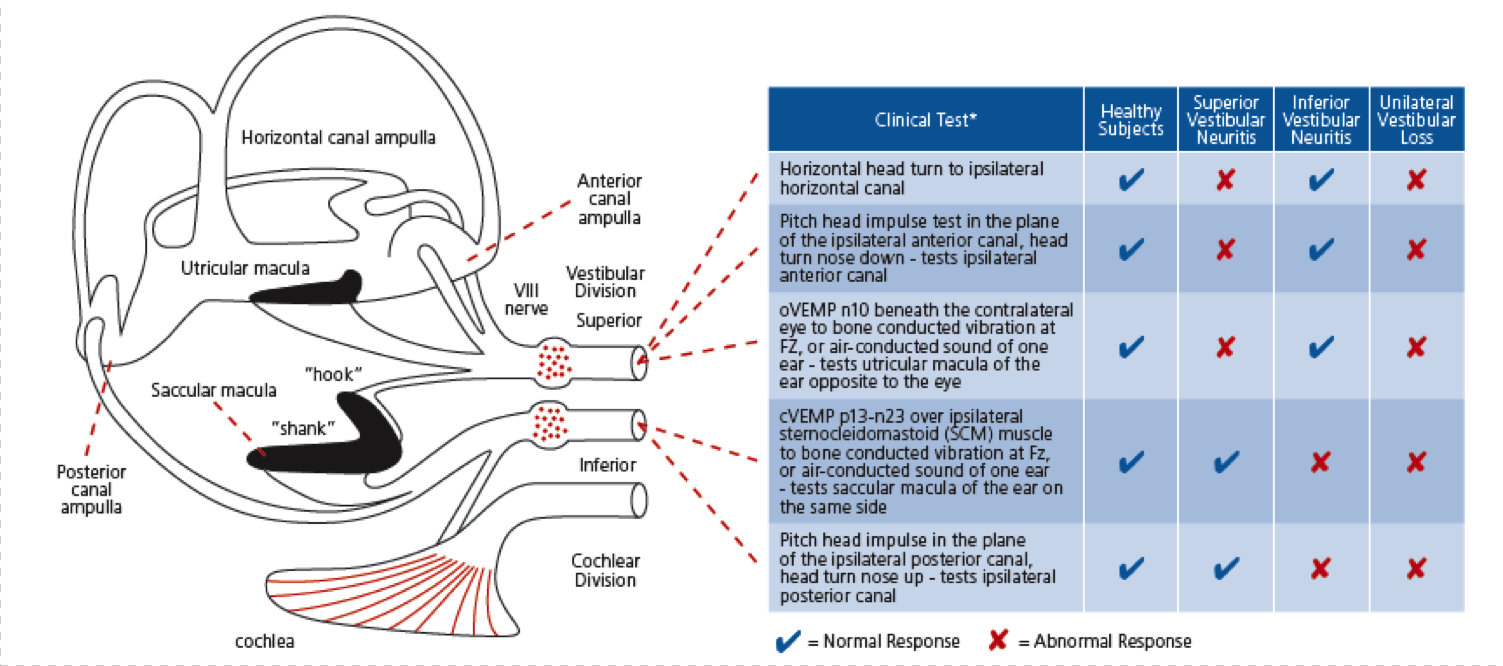 Tests of the peripheral vestibular system and the corresponding anatomy