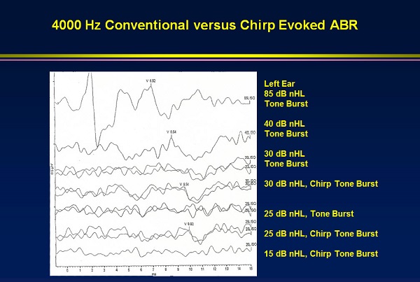 Comparison of 4000 Hz tone burst to 4000 Hz chirps