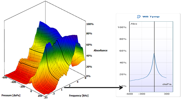 A diagram for plotting findings for tympanometry and acoustic reflexes