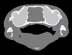 segmentation of a frog's head