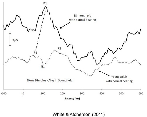 Comparison of CAEP in a toddler to a young adult