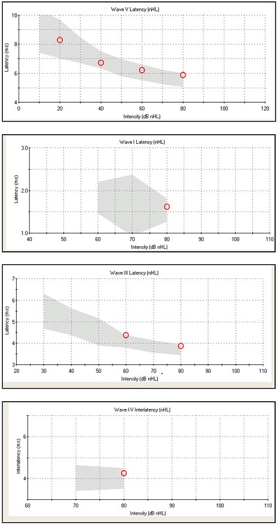 A normal bera waveform  Download Scientific Diagram