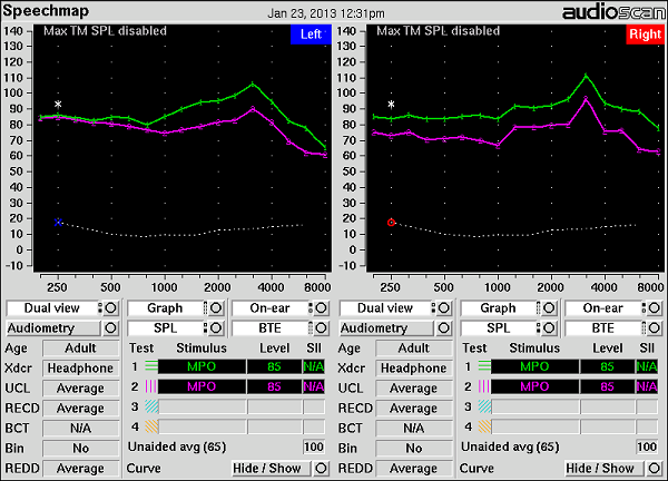 Verification of well-fitted versus poorly-fitting flat attenuation earplugs