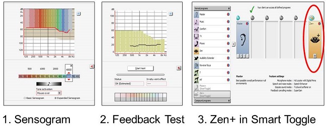 Programming Zen in three simple steps. Sensogram, feedback test, Zen+ in Smart Toggle