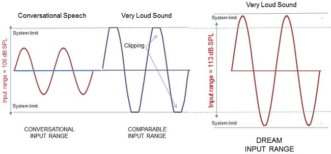 Comparison of traditional hearing aid with 106 dB SPL input range and Widex Dream hearing aid with 113 dB SPL input range