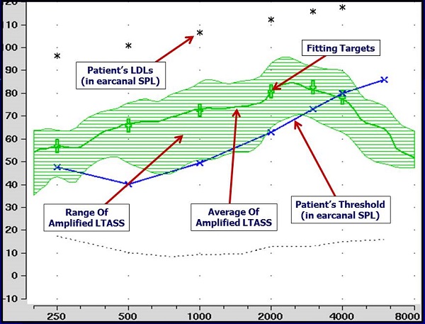 Example of hearing aid output using a real-speech input with match to NAL-NL2 prescriptive targets for 65-dB input