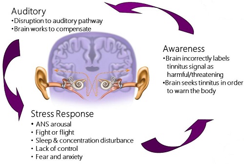 Illustration of the neurophysiological model of tinnitus