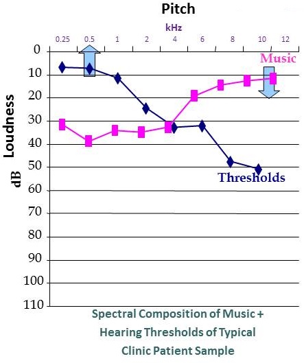Spectral composition of music compared to a typical sensorineural hearing loss