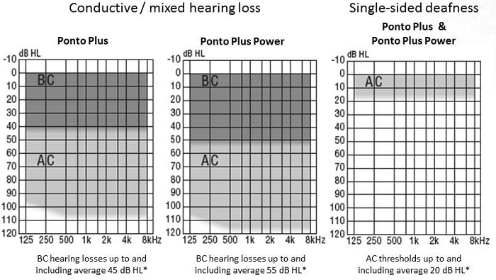 Fitting ranges required for Ponto Plus and Ponto Plus Power