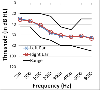 The mean audiogram and the range of hearing loss for the right and left ears for the 20 participants in this study